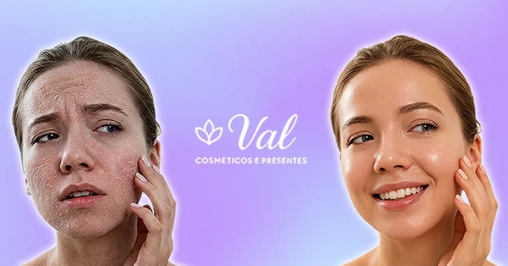 Montagem explicativa mostrando o contraste entre uma pele feminina seca e descamando pelo frio do inverno e, ao lado, uma pele do rosto saudável, hidratada e com viço com produtos da Val Cosméticos.